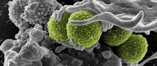 Anti-Microbial Peptides Market: Potential Chronic Diseases Drug And Alternatives For Antibiotics